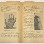 Еллинек С. Несчастные случаи при пользовании радиоустановками. 9