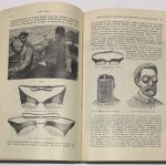 Хирш Людвиг. Профессиональные болезни глаз. 7