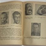 Энтин Д.А. Доврачебная медицинская помощь и уход при челюстно-лицевых ранениях. 5