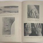 Радайкин С.Д. Патология и терапия поражений БОВ. 8